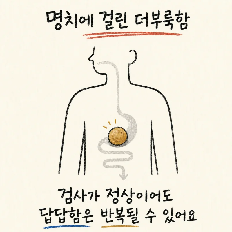 인천 송도 명치 답답 · 명치 더부룩