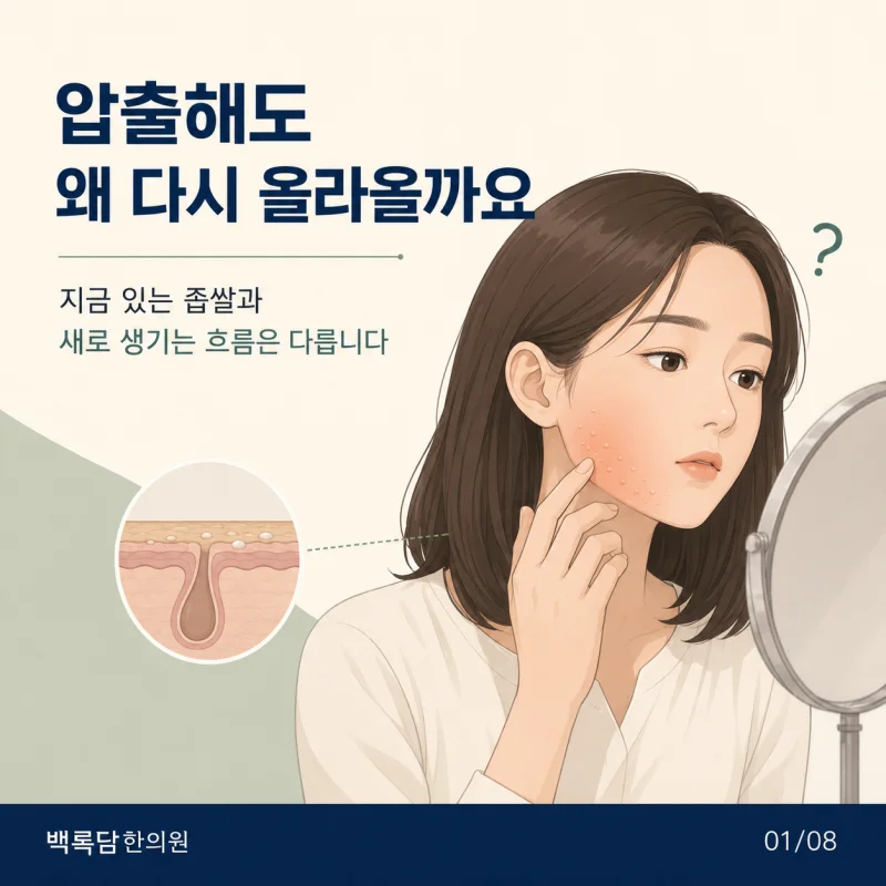 압출해도 계속 생기는 턱 좁쌀 여드름, 상열감과 피지 균형을 함께 보는 이유 | 인천 송도 여드름 한의원