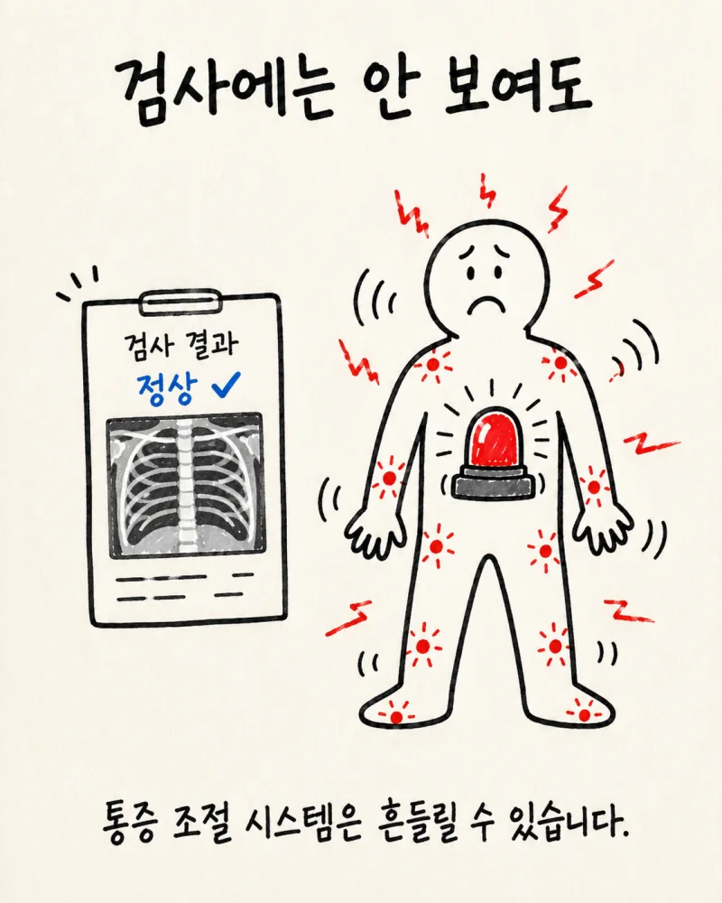 섬유근육통이란?
